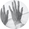 Parkinson Parkinson